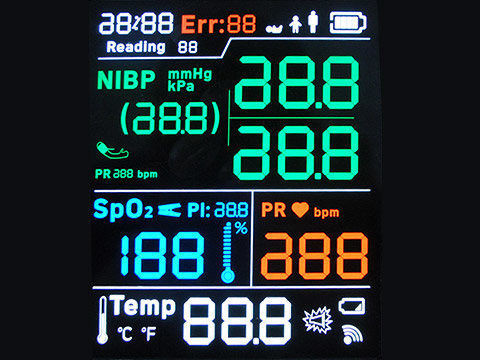 FSTNの肯定的な白黒LCDは入れられた電池のための3.3V範囲を表示する